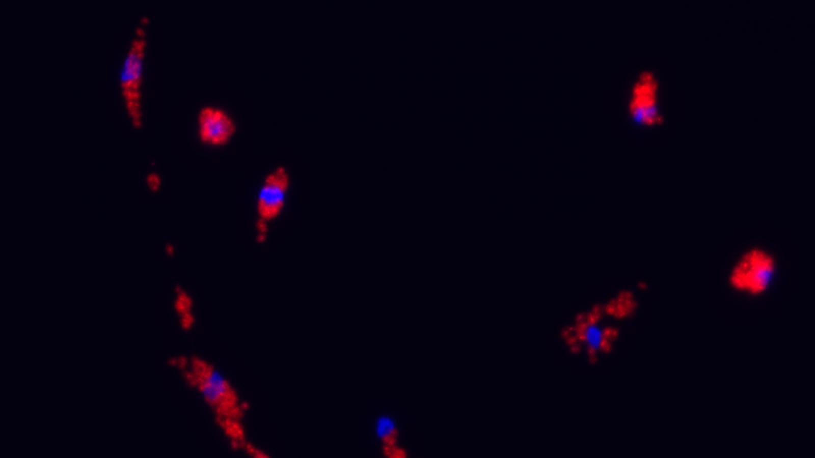May-Grünwald-Giemsa staining of human iPSC-derived macrophages (IPSDM) showing macrophage-like morphology.