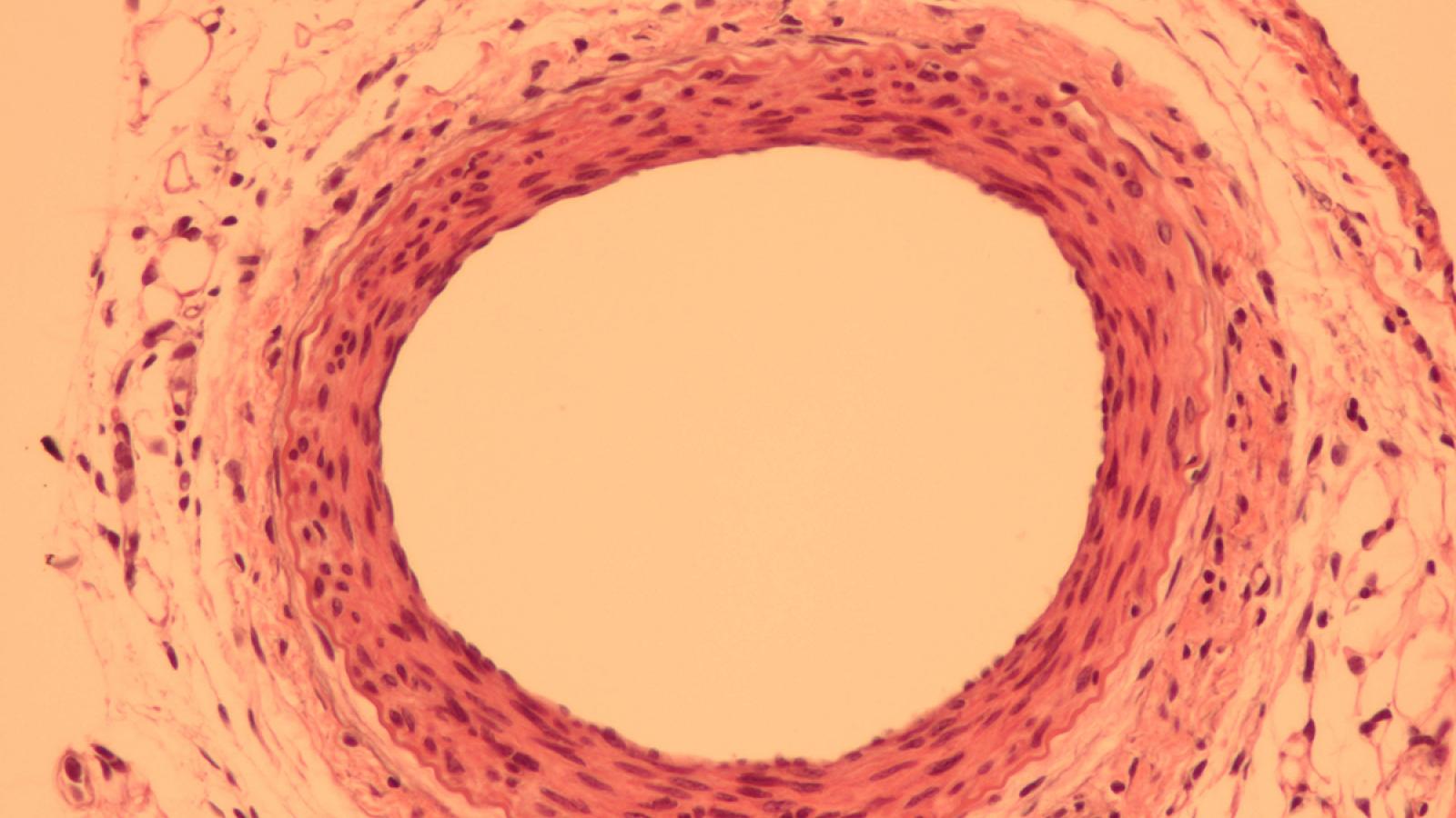 Vascular injury mouse models reveal a role for Adamts7 in neointimal formation in response to injury.
