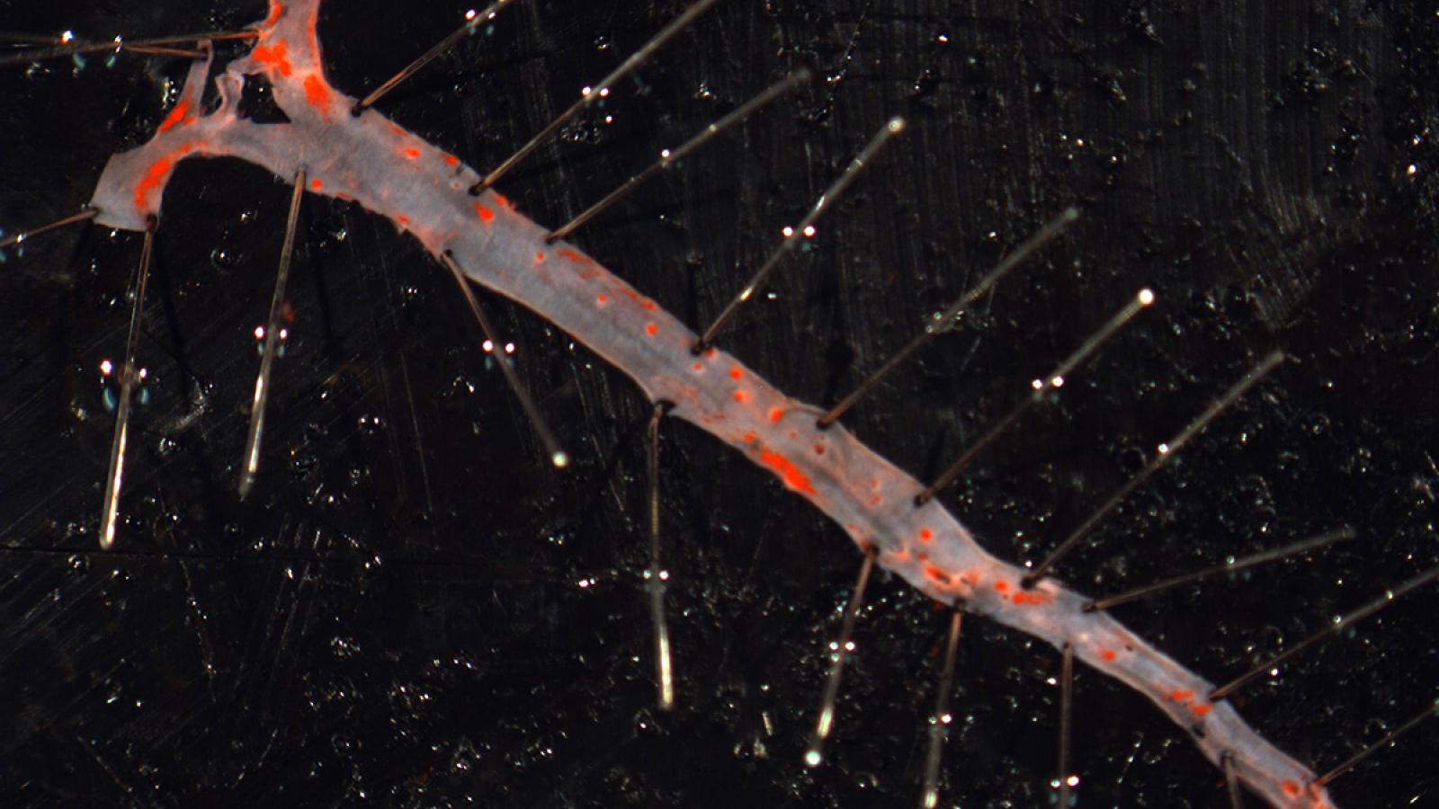 Using hyperlipidemic mouse models of atherosclerosis, we showed that Adamts7 activity is proatherogenic.