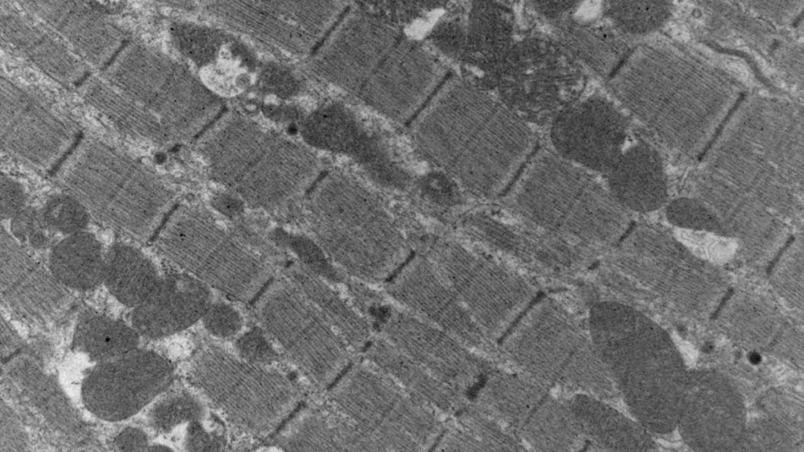 Electron microscopy of F1759A-Na(V)1.5 mouse atria shows myofibril disarray