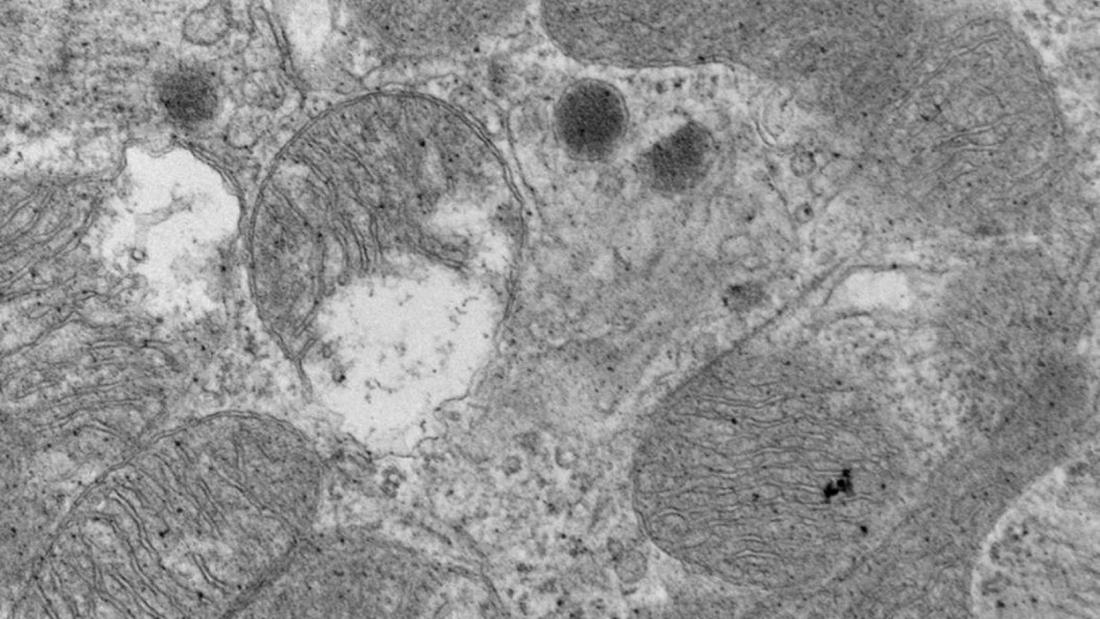 Electron microscopy of F1759A-Na(V)1.5 mouse atria shows ultra-structural changes in the mitochondria