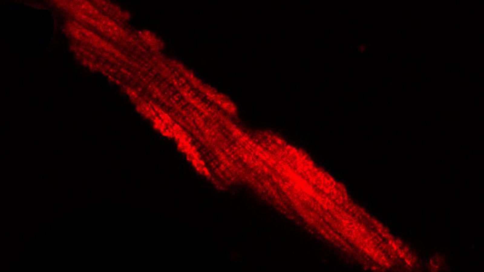Increased Mitosox staining in atrial cardiomyocytes from F1759A-Na(V)1.5 mouse