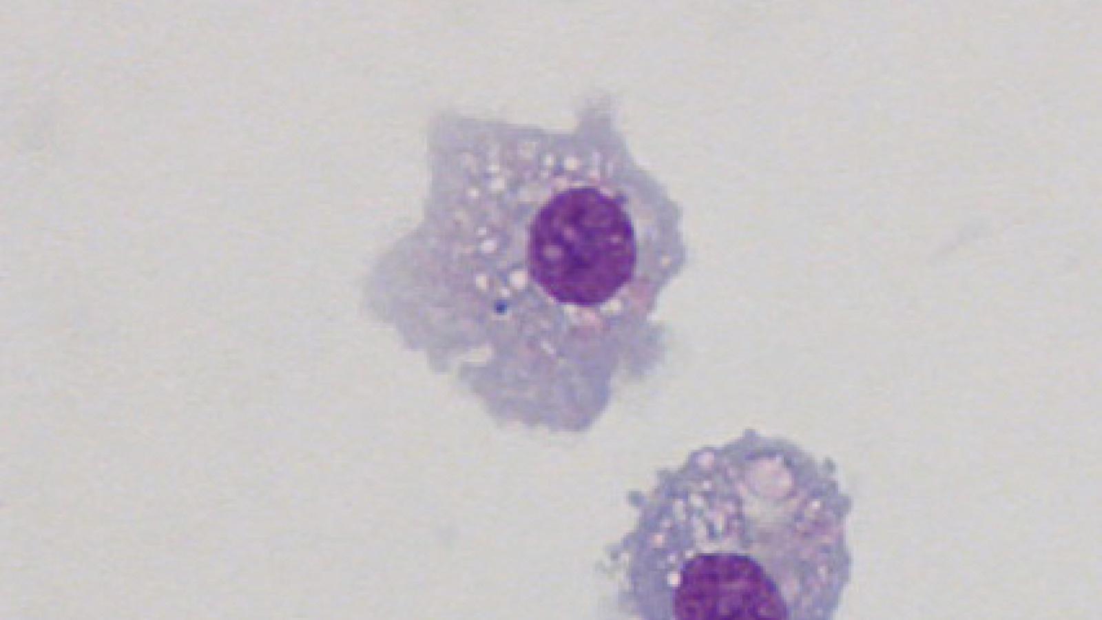 May-Grünwald-Giemsa staining of human iPSC-derived macrophages (IPSDM) showing macrophage-like morphology.