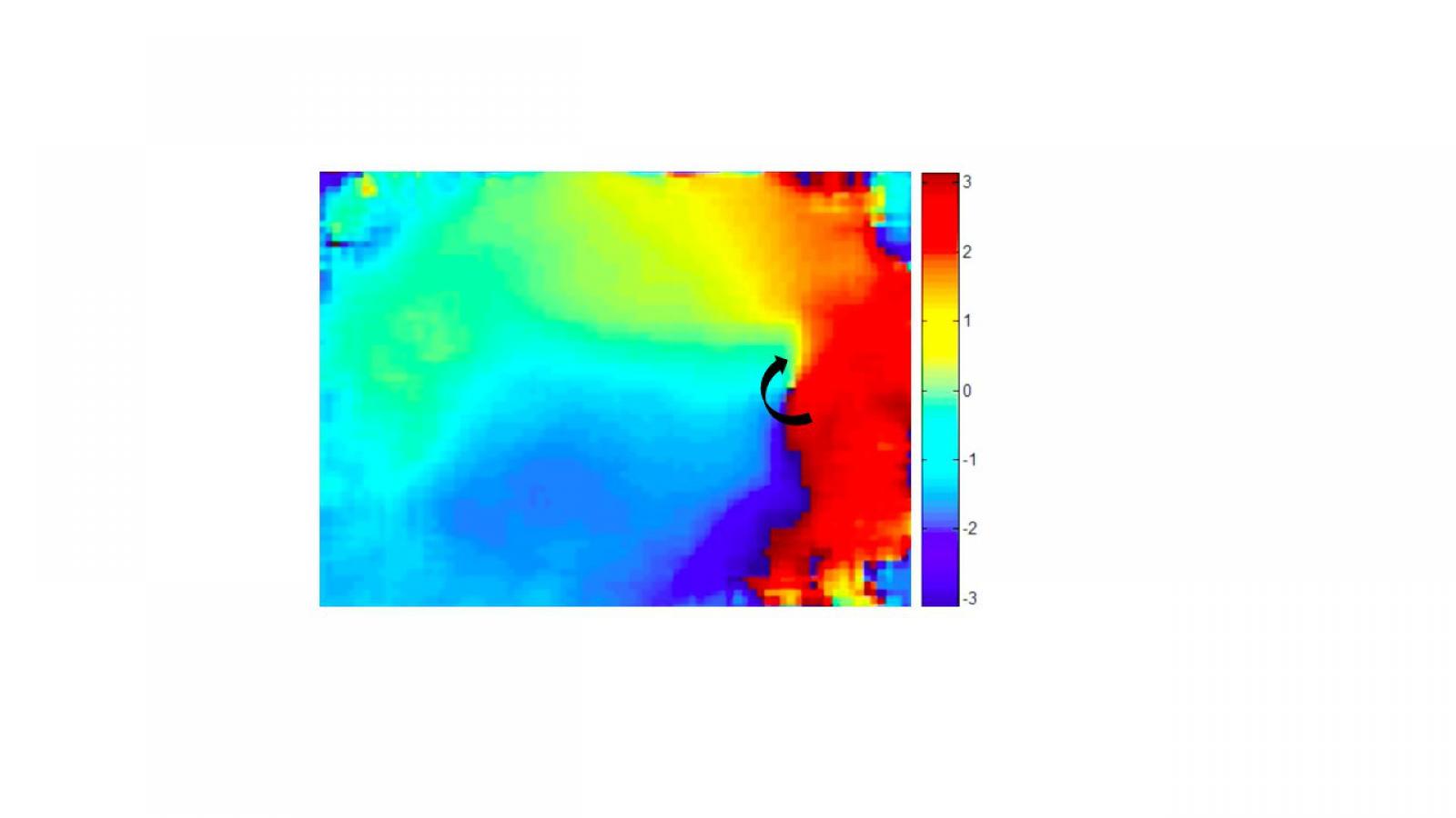 Reentry in the optically mapped F1759A-Na(V)1.5 mouse atria
