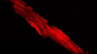 Increased Mitosox staining in atrial cardiomyocytes from F1759A-Na(V)1.5 mouse